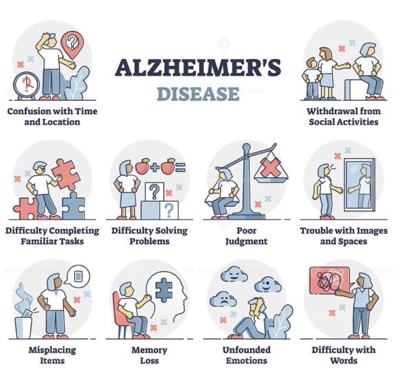 Alzheimers outline