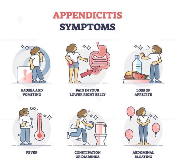 Appendicitis Symptoms outline set