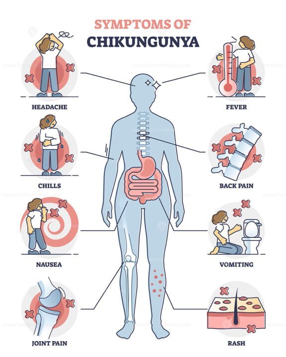 Chikungunya outline set