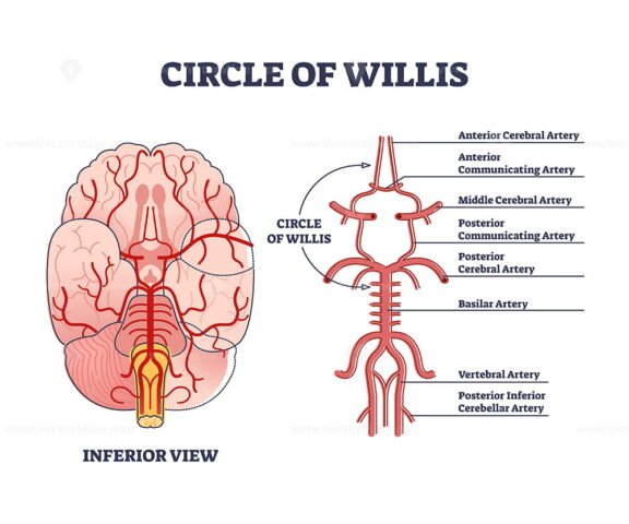 Circle of Willis outline