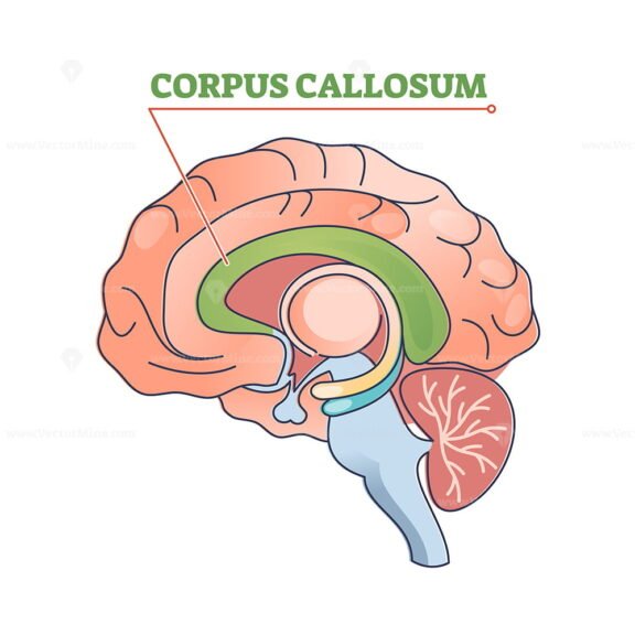 Corpus Callosum outline