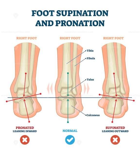 Foot Supination and Pronation