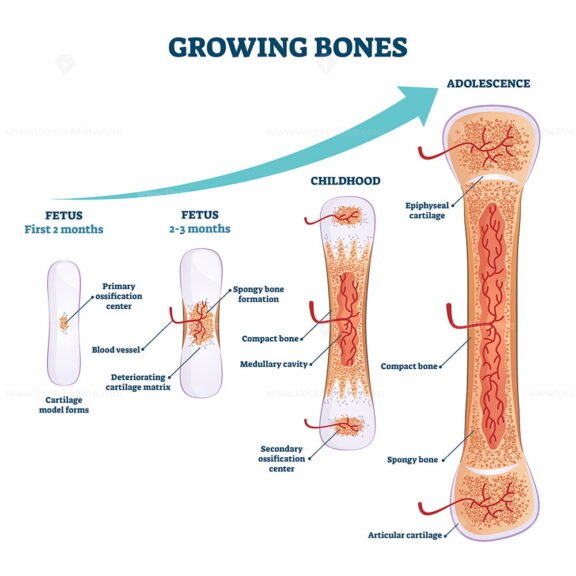 Growing Bones