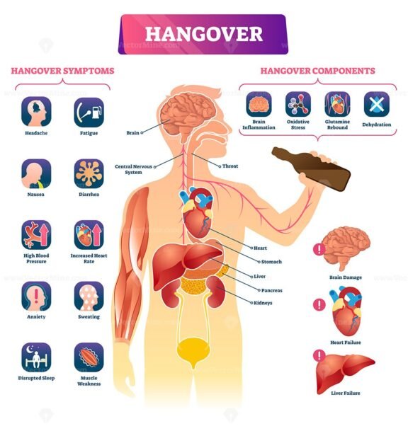 Hangover diagram