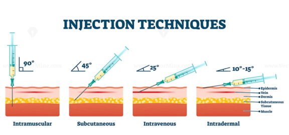 Injection Techniques