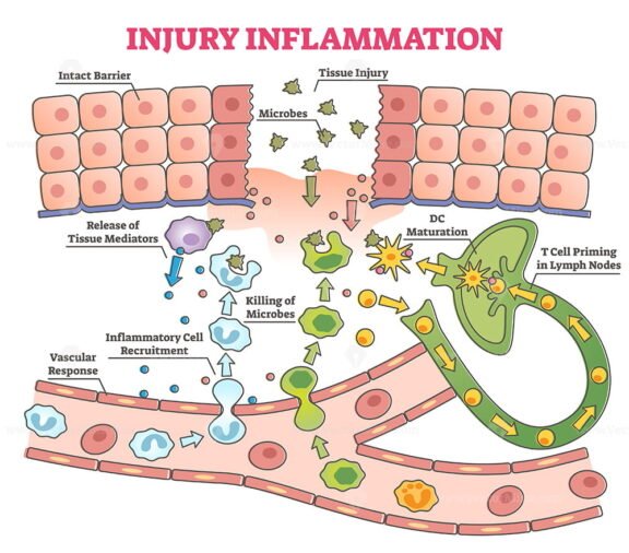 Injury Inflammation outline
