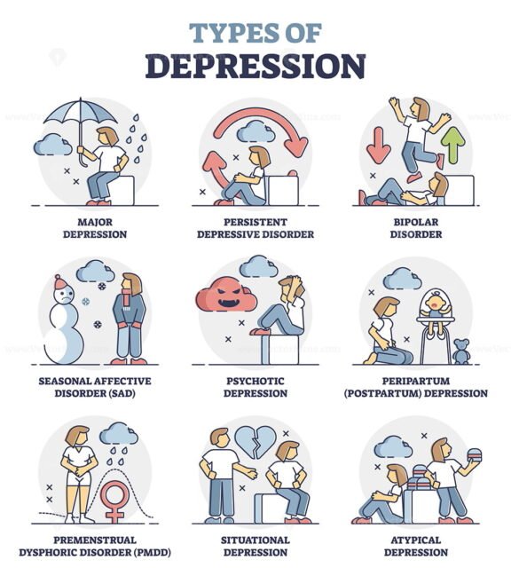 Types of Depression outline