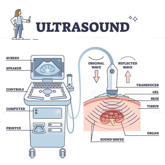 Ultrasound outline diagram