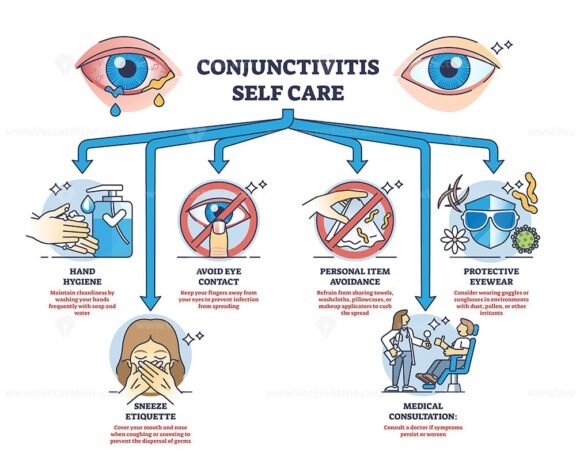 conjunctivitis self care outline diagram 1