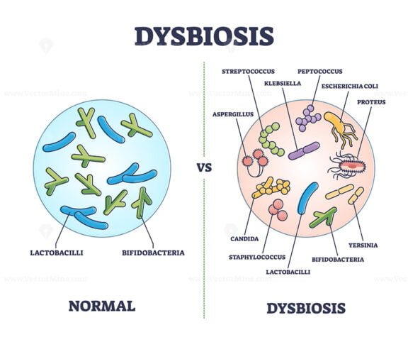dysbiosis 2 outline 1