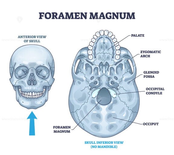 foramen magnum outline 1