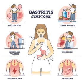 gastritis 2 outline diagram 1