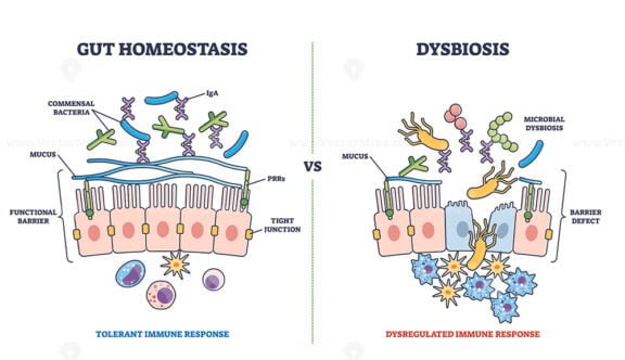gut homeostasis and dysbiosis outline 1