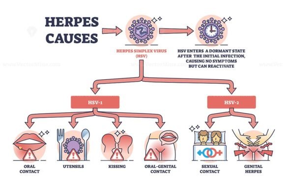 herpes causes outline 1