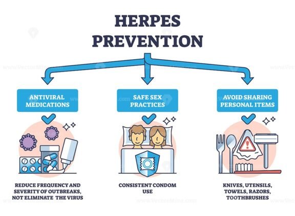herpes prevention outline 1