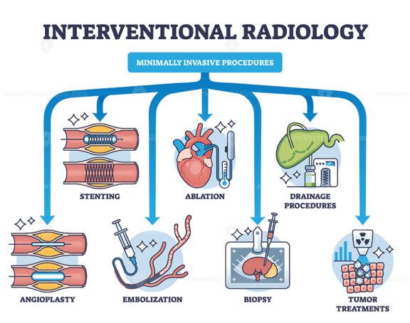 interventional radiology outline diagram 1