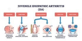 juvenile idiopathic arthritis jia diagram 1