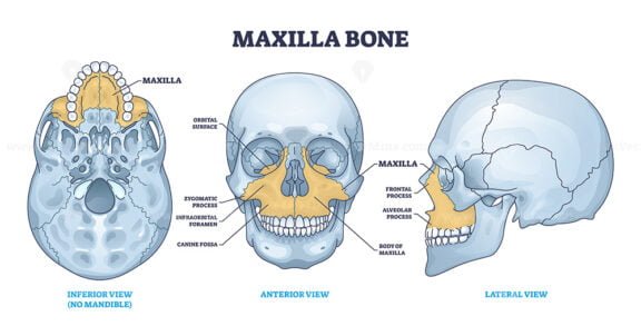 maxilla bone outline 1