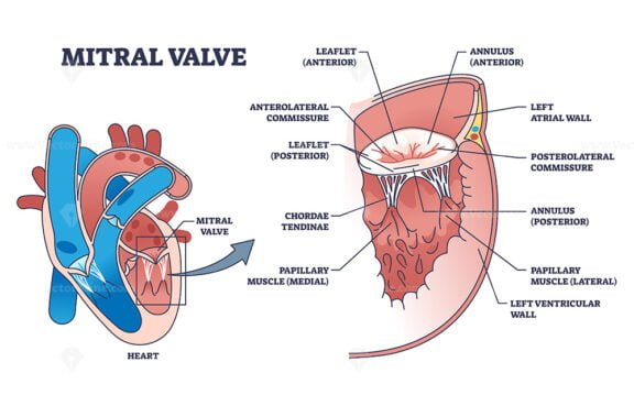 mitral valve outline diagram 1