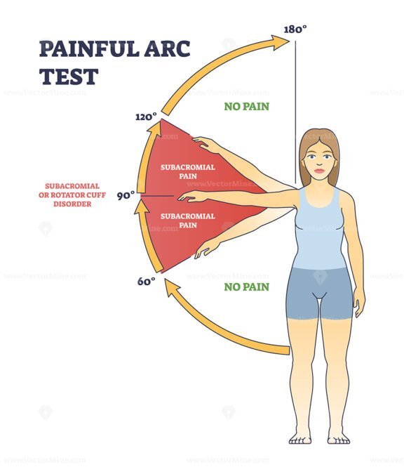 painful arc test outline diagram 1