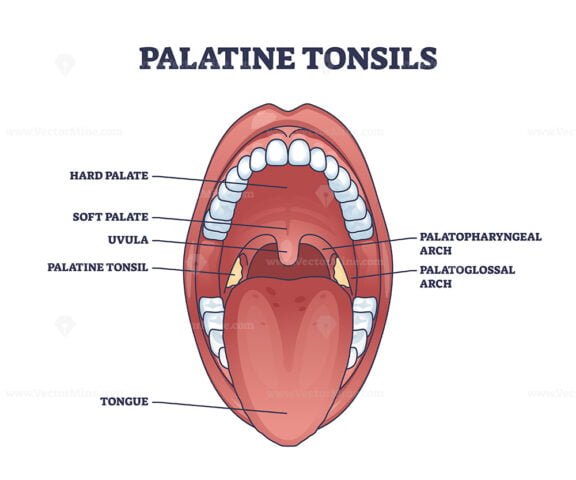 palatine tonsils in the oropharynx outline 1