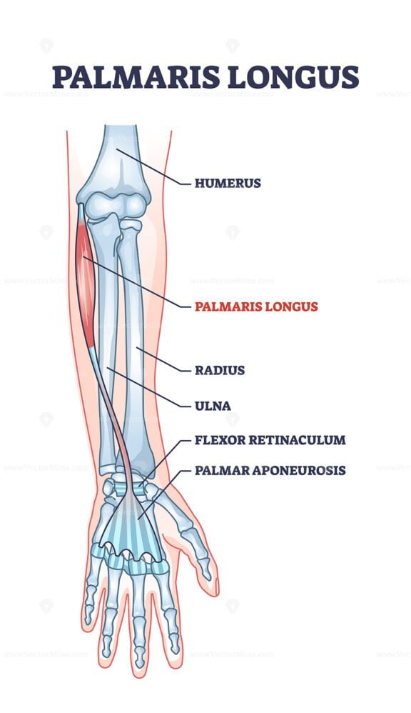 palmaris longus outline diagram 1