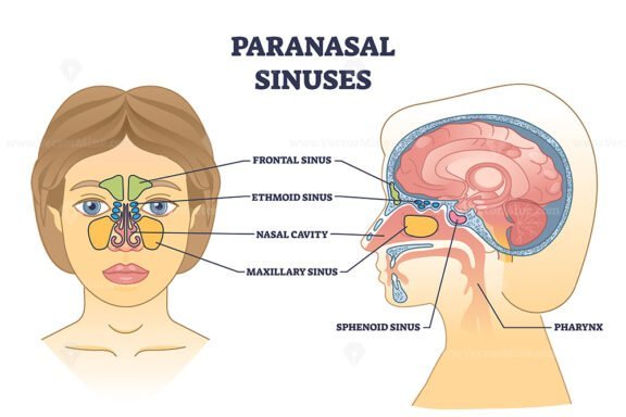 paranasal sinuses outline 1