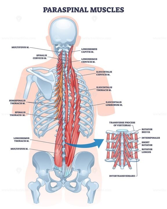 paraspinal muscles outline diagram 1