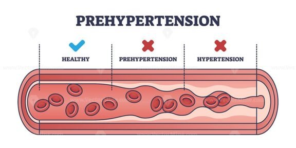 prehypertension outline diagram 1