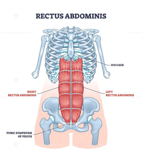 rectus abdominis outline 1