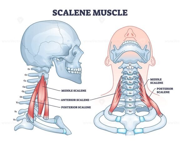 scalene muscle outline diagram 1