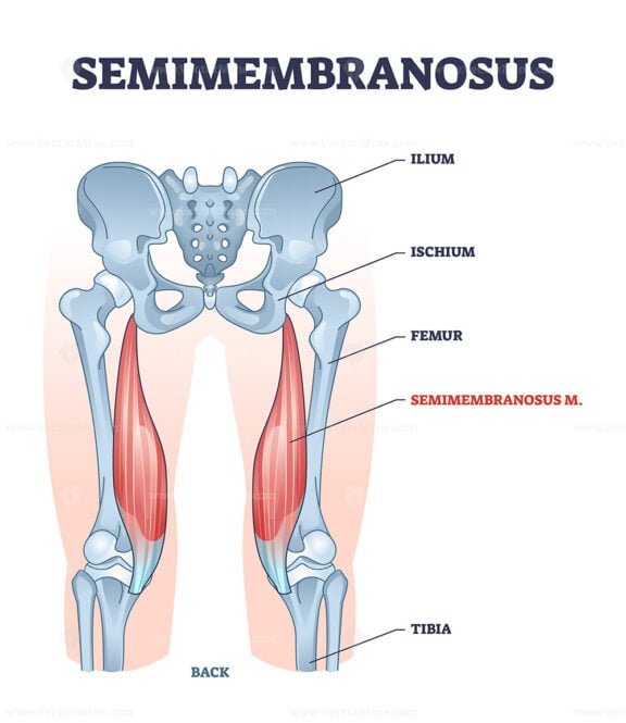 semimembranosus outline diagram 1
