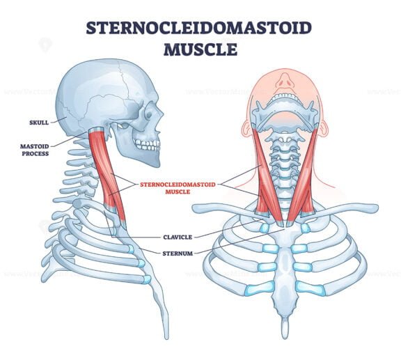 sternocleidomastoid outline 1