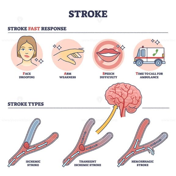 stroke 2 outline 1