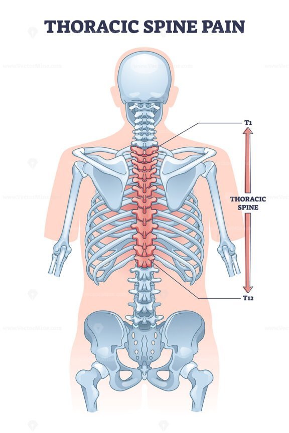 thoracic spine pain outline 1