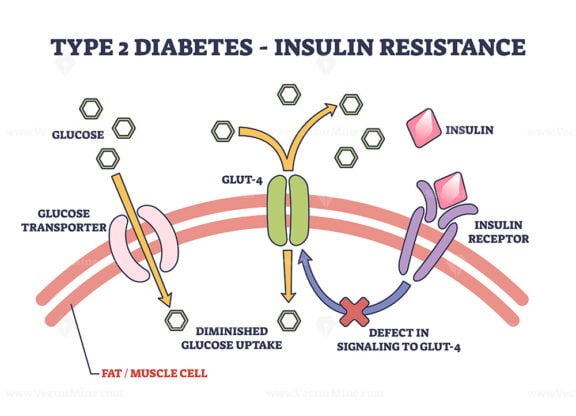 type 2 diabetes insulin resistance outline diagram 1
