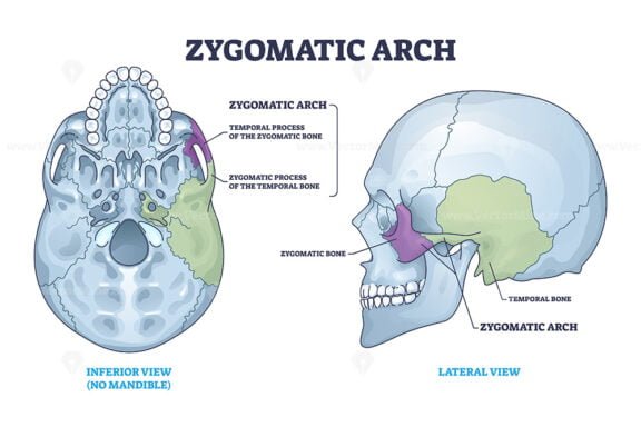 zygomatic arch outline 1