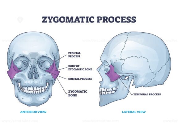 zygomatic process outline 1