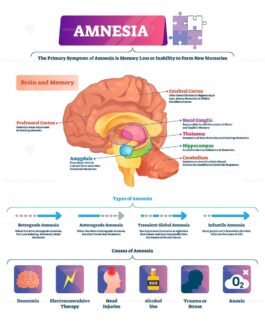 Amnesia vector illustration - VectorMine