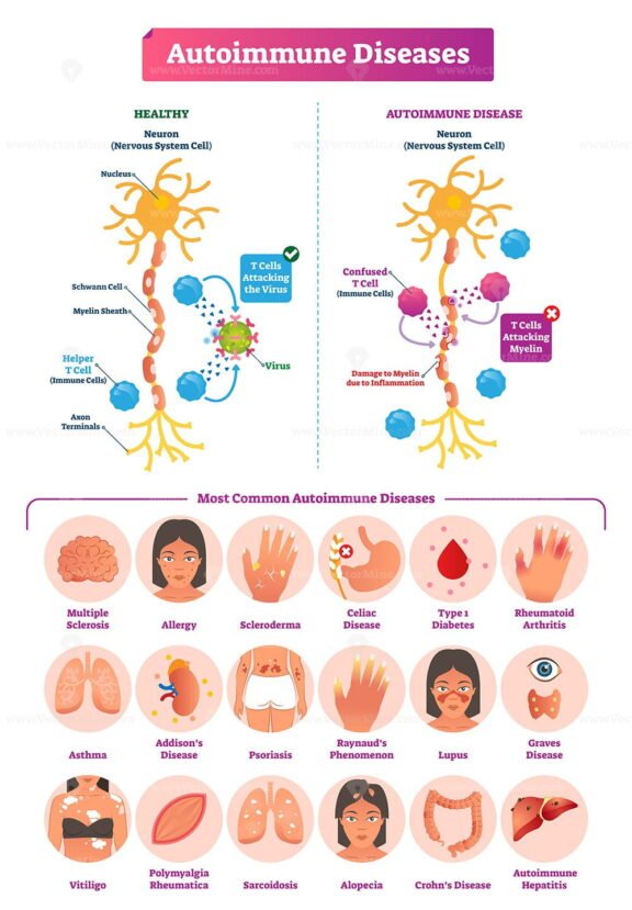 Autoimmune Diseases