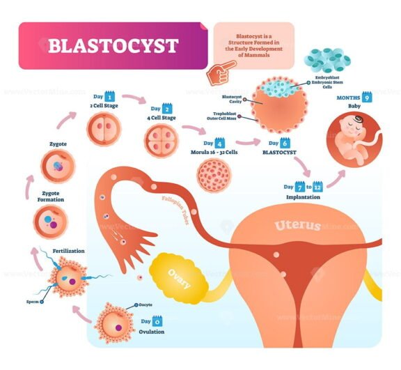 Blastocysts