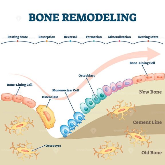 Bone Remodeling