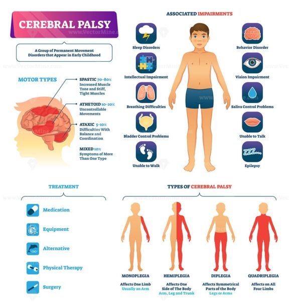 Cerebral Palsy