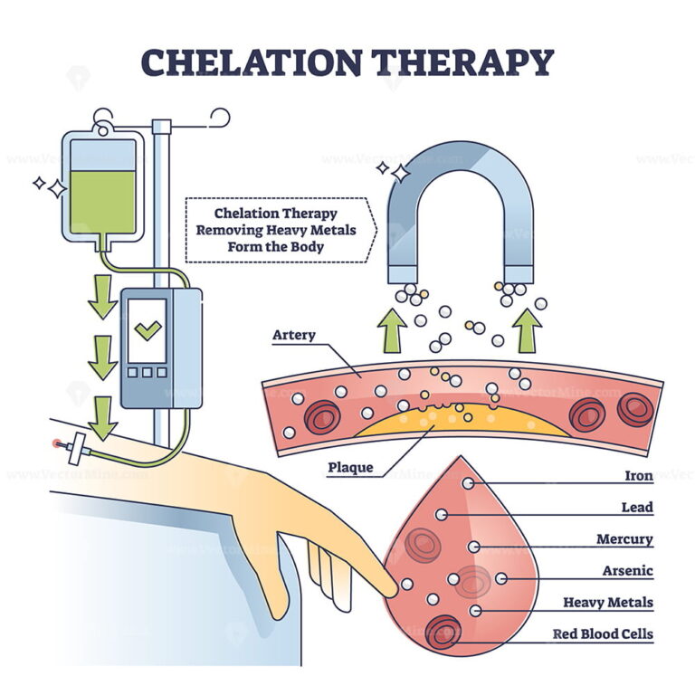 Chelation Therapy For Toxic Heavy Metal Medical Treatment Outline ...