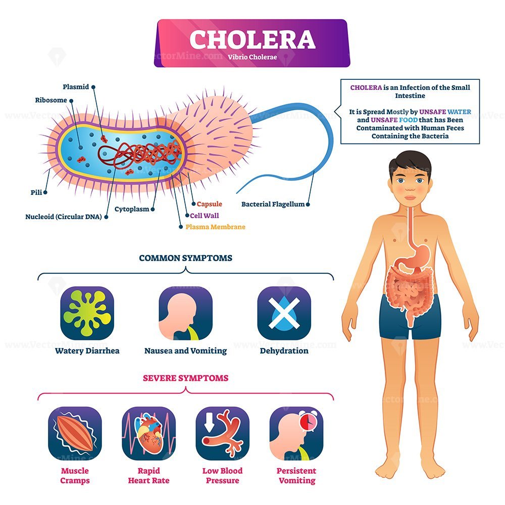 Cholera vector illustration VectorMine