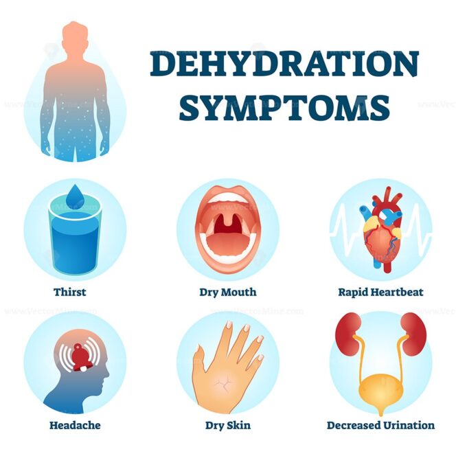 Dehydration symptoms vector illustration - VectorMine