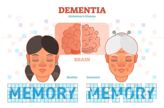 FREE Dementia or alzheimer's disease concept vector illustration