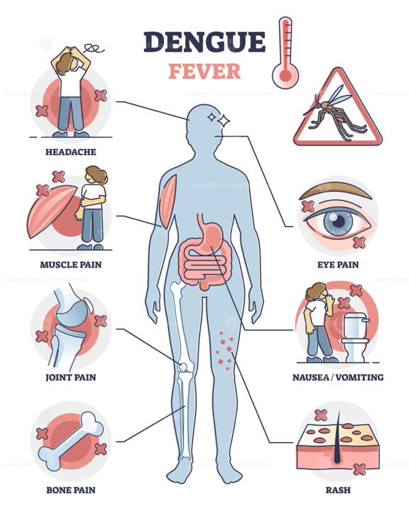 Dengue fever symptoms awareness poster, educational vector illustration ...