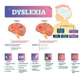 Dyslexia vector illustration – VectorMine