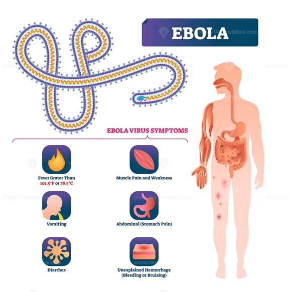 Ebola